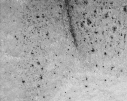 Markedly reduced amyloid plaque after a 10-day low-dose Alzyme course, original grayscale histology
